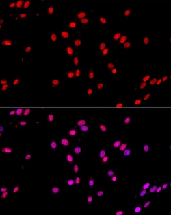 Invitrogen c-Jun Polyclonal Antibody 100 &mu;L; Unconjugated:Antibodies,