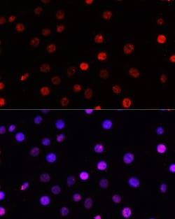 Invitrogen TCF4 Polyclonal Antibody 100 &mu;L; Unconjugated:Antibodies,