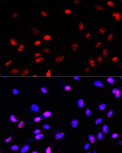 Invitrogen TCF4 Polyclonal Antibody 100 &mu;L; Unconjugated:Antibodies,