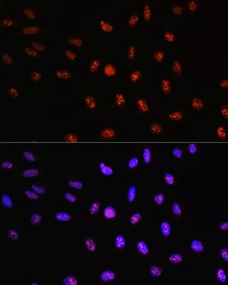 Invitrogen TCF4 Polyclonal Antibody 100 &mu;L; Unconjugated:Antibodies,