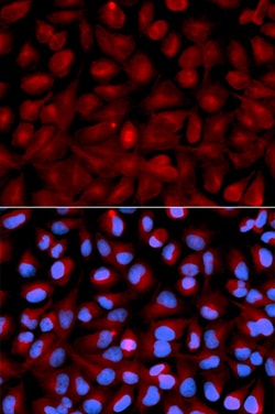 Invitrogen HDAC6 Polyclonal Antibody 100 &mu;L | Buy Online | Invitrogen&trade; | Fisher Scientific