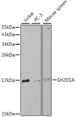 Invitrogen SAP (SLAM-Associated Protein) Polyclonal Antibody 100 &mu;L;