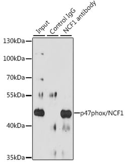 Invitrogen p47phox Polyclonal Antibody 100 &mu;L | Buy Online | Invitrogen&trade; | Fisher Scientific