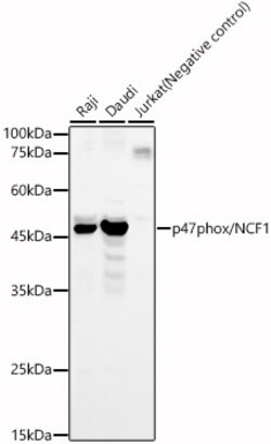 Invitrogen p47phox Polyclonal Antibody 100 &mu;L | Buy Online | Invitrogen&trade; | Fisher Scientific