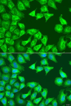 Invitrogen SQSTM1 Polyclonal Antibody 100 &mu;L; Unconjugated:Antibodies,