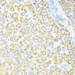 Invitrogen SQSTM1 Polyclonal Antibody 100 &mu;L; Unconjugated:Antibodies,