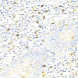 Invitrogen SQSTM1 Polyclonal Antibody 100 &mu;L; Unconjugated:Antibodies,