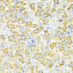 Invitrogen SQSTM1 Polyclonal Antibody 100 &mu;L; Unconjugated:Antibodies,