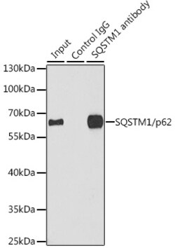 Invitrogen SQSTM1 Polyclonal Antibody 100 &mu;L; Unconjugated:Antibodies,
