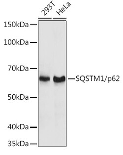 Invitrogen SQSTM1 Polyclonal Antibody 100 &mu;L; Unconjugated:Antibodies,