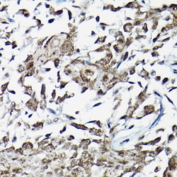 Invitrogen SMAD2 Polyclonal Antibody 100 &mu;L; Unconjugated:Antibodies,