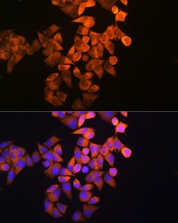 Invitrogen RRM1 Polyclonal Antibody 100 &mu;L; Unconjugated:Antibodies,