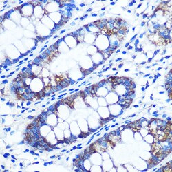 Invitrogen RRM1 Polyclonal Antibody 100 &mu;L; Unconjugated:Antibodies,