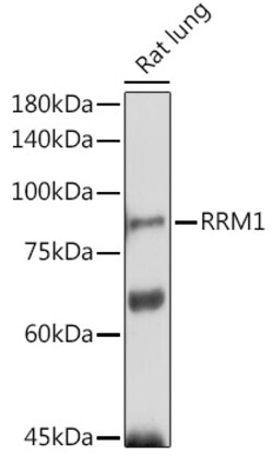 Invitrogen RRM1 Polyclonal Antibody 100 &mu;L; Unconjugated:Antibodies,