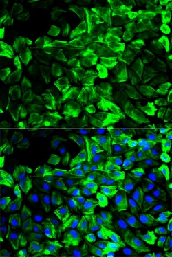Invitrogen TPM1 Polyclonal Antibody 100 &mu;L; Unconjugated:Antibodies,