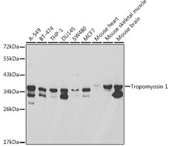 Invitrogen TPM1 Polyclonal Antibody 100 &mu;L; Unconjugated:Antibodies,