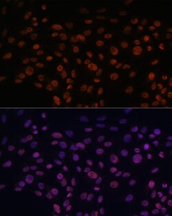 Invitrogen CHD4 Polyclonal Antibody 100 &mu;L; Unconjugated:Antibodies,