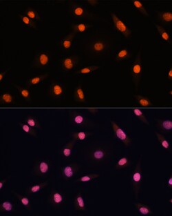 Invitrogen CHD4 Polyclonal Antibody 100 &mu;L; Unconjugated:Antibodies,