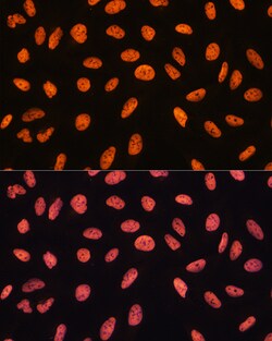 Invitrogen CHD4 Polyclonal Antibody 100 &mu;L; Unconjugated:Antibodies,