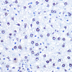 Invitrogen CHD4 Polyclonal Antibody 100 &mu;L; Unconjugated:Antibodies,