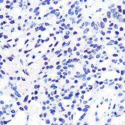 Invitrogen CHD4 Polyclonal Antibody 100 &mu;L; Unconjugated:Antibodies,