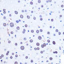 Invitrogen CHD4 Polyclonal Antibody 100 &mu;L; Unconjugated:Antibodies,