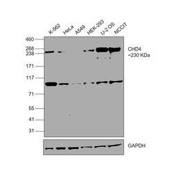 Invitrogen CHD4 Polyclonal Antibody 100 &mu;L; Unconjugated:Antibodies,