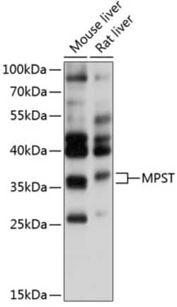 Invitrogen MPST Polyclonal Antibody 100 &mu;L; Unconjugated:Anticuerpos