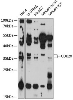 Invitrogen CDK20 Polyclonal Antibody 100 &mu;L; Unconjugated:Antibodies,