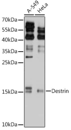 Invitrogen Destrin Polyclonal Antibody 100 &mu;L; Unconjugated:Antibodies,