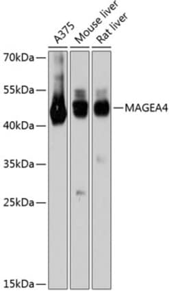 Invitrogen MAGEA4 Polyclonal Antibody 100 &mu;L; Unconjugated:Antibodies,