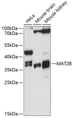 Invitrogen MAT2B Polyclonal Antibody 100 &mu;L; Unconjugated:Antibodies,