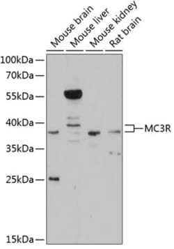 Invitrogen MC3R Polyclonal Antibody 100 &mu;L | Buy Online | Invitrogen&trade; | Fisher Scientific