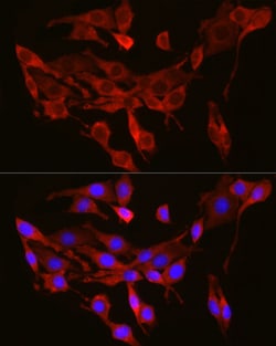 Invitrogen SEC61A1 Polyclonal Antibody 100 &mu;L; Unconjugated:Antibodies,