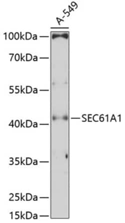 Invitrogen SEC61A1 Polyclonal Antibody 100 &mu;L; Unconjugated:Antibodies,