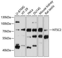 Invitrogen NT5C2 Polyclonal Antibody 100 &mu;L; Unconjugated:Antibodies,