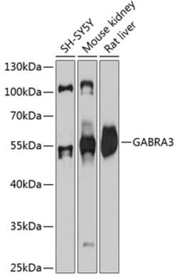 Invitrogen GABRA3 Polyclonal Antibody 100 &mu;L | Buy Online | Invitrogen&trade; | Fisher Scientific