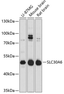 Invitrogen SLC30A6 Polyclonal Antibody 100 &mu;L; Unconjugated:Antibodies,