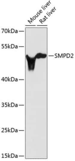 Invitrogen SMPD2 Polyclonal Antibody 100 &mu;L; Unconjugated:Antibodies,