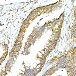 Invitrogen NKCC1 Polyclonal Antibody 100 &mu;L; Unconjugated:Antibodies,
