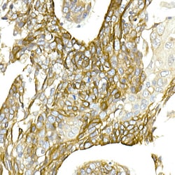 Invitrogen NKCC1 Polyclonal Antibody 100 &mu;L; Unconjugated:Antibodies,