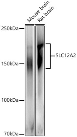 Invitrogen NKCC1 Polyclonal Antibody 100 &mu;L; Unconjugated:Antibodies,