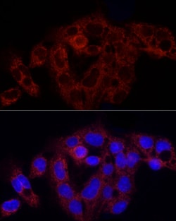 Invitrogen RPS18 Polyclonal Antibody 100 &mu;L | Buy Online | Invitrogen&trade; | Fisher Scientific