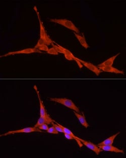 Invitrogen RPS18 Polyclonal Antibody 100 &mu;L | Buy Online | Invitrogen&trade; | Fisher Scientific