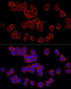 Invitrogen RPS18 Polyclonal Antibody 100 &mu;L | Buy Online | Invitrogen&trade; | Fisher Scientific