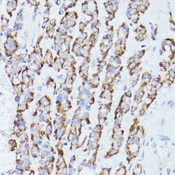 Invitrogen RPS18 Polyclonal Antibody 100 &mu;L | Buy Online | Invitrogen&trade; | Fisher Scientific