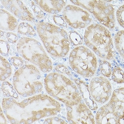 Invitrogen RPS18 Polyclonal Antibody 100 &mu;L | Buy Online | Invitrogen&trade; | Fisher Scientific