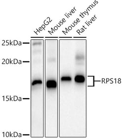 Invitrogen RPS18 Polyclonal Antibody 100 &mu;L | Buy Online | Invitrogen&trade; | Fisher Scientific