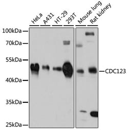 Invitrogen CDC123 Polyclonal Antibody 100 &mu;L; Unconjugated:Antibodies,