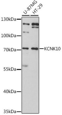 Invitrogen KCNK10 Polyclonal Antibody 100 &mu;L; Unconjugated:Antibodies,